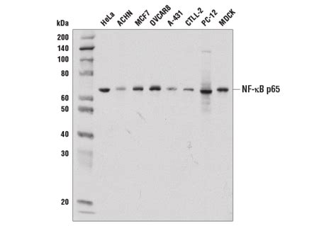 Nf B P D E Xp Rabbit Mab Bsa And Azide Free