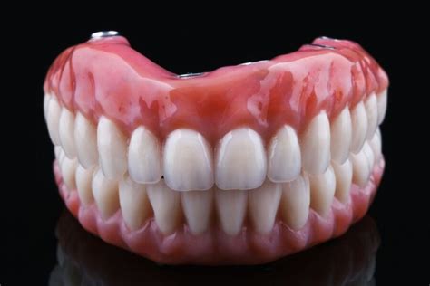 Guía completa sobre prótesis dentales Laborprothesis