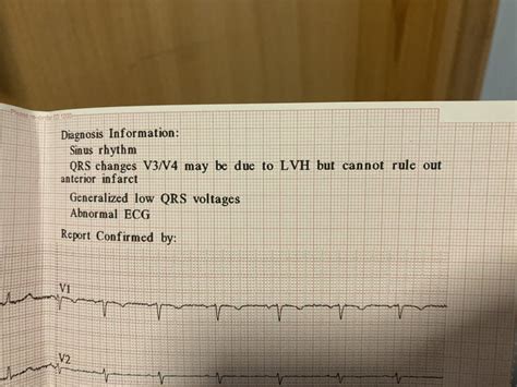 Abnormal ECG - GP not concerned? | Mumsnet