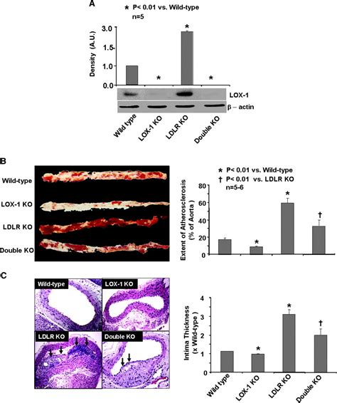 Deletion Of LOX 1 Reduces Atherogenesis In LDLR Knockout Mice Fed High