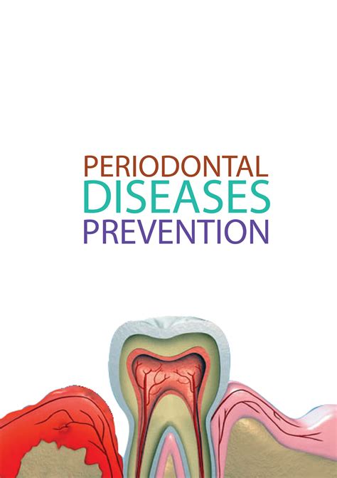 Info Graphics For Periodontal Diseases Prevention On Behance