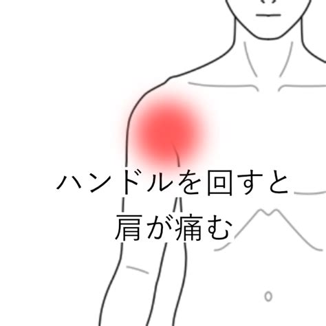 車のハンドルを回すと肩が痛む｜肩痛（スポーツ障害・怪我）のツボ｜ツボネット 鍼灸の症例が検索できるツボ辞典