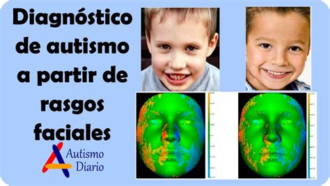 AutismoDiario on Twitter Diagnóstico de autismo a partir de rasgos