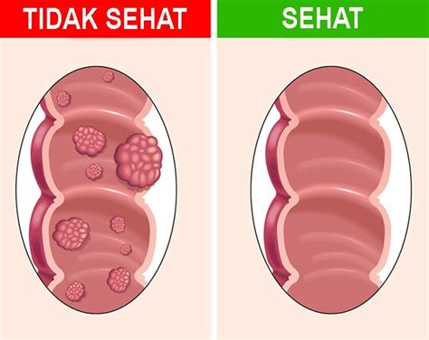 Ini Yang Akan Terjadi Pada Tubuh Jika Anda Makan Biji Buah Kurma