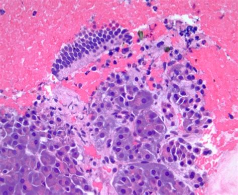 Pathology Outlines Cytology