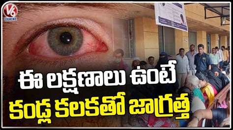 Conjunctivitis Cases Rising Rapidly In Hyderabad Infections Are On A