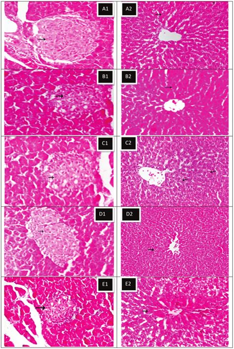 Pancreatic And Hepatic Tissues Histopathology Pancreas A1 Normal