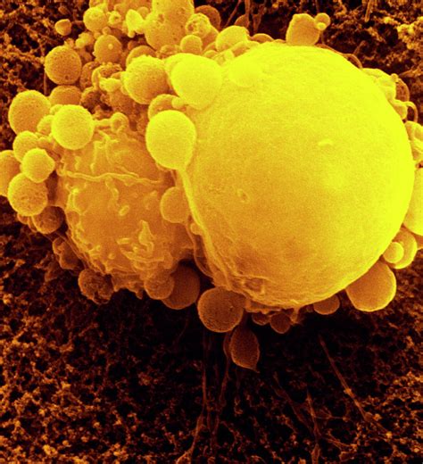 Sem Of T Lymphocyte Killer Cell Photograph By Dr Andrejs Liepins