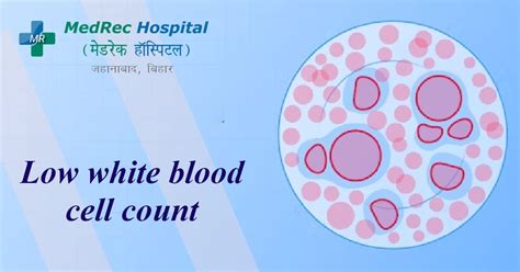 Low White Blood Cell Count Detailed Overview