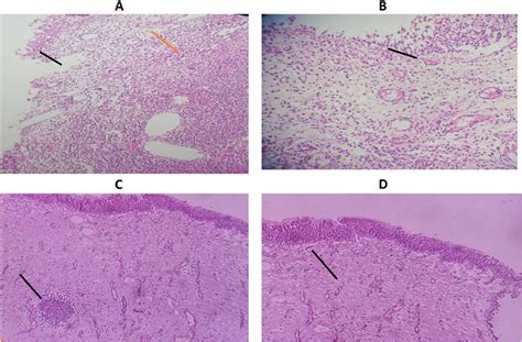 Histological Picture Of Rat Urinary Bladder Histopathology Was Taken