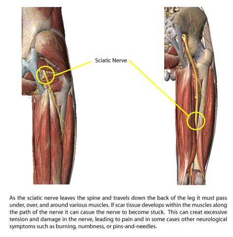 Sciatic Nerve Anatomy Diagram