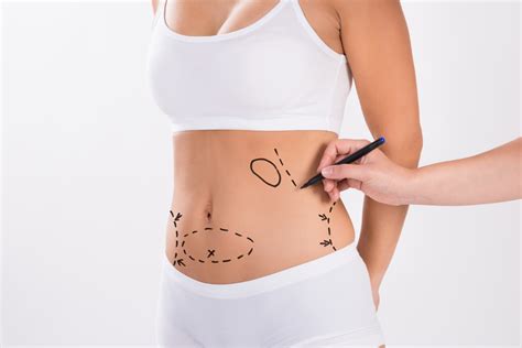 Ultrasonic Liposuction Vs Traditional Liposuction Asps