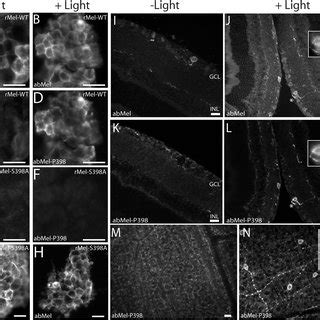 Photomicrographs Showing Immunostaining For Melanopsin And