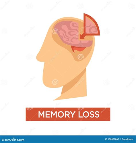 Memory Loss Medical Problem Human Brain Anatomy Stock Vector ...