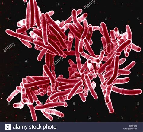 Mycobacterium Tuberculosis Estas Bacterias Gram Positivas En Forma De