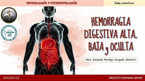 Hemorragia Digestiva Alta Baja Y Oculta Amanda Serqu N Udocz