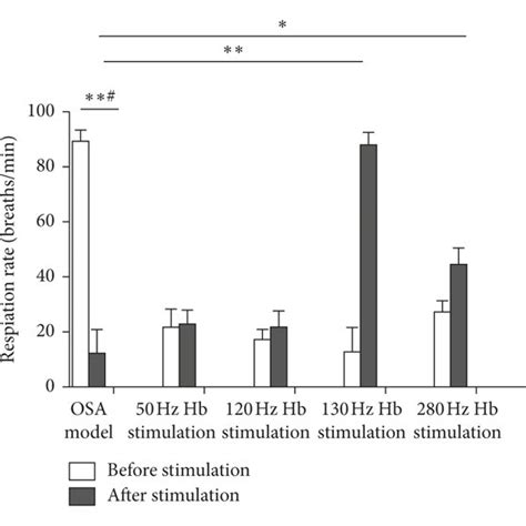 Typical Respiration And Genioglossus EMG Patterns After 130 Hz