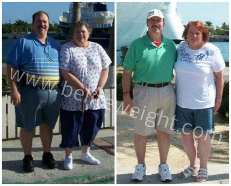 Almost Divorced Over Gastric Sleeve Surgery In Mexico Beliteweight Weight Loss Services