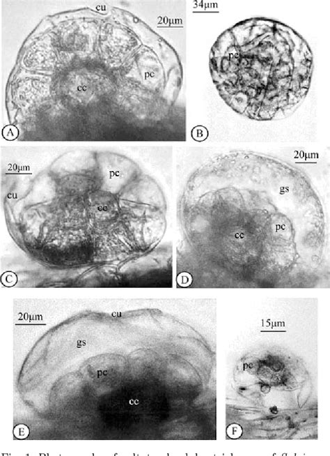 Figure 1 From Structural Investigation Of The Glandular Trichomes Of