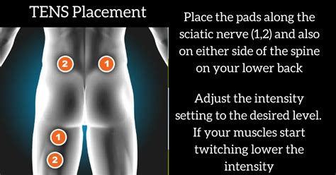 TENS Unit Placement For Sciatica Nerve Pain – Optimize Health 365