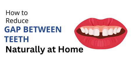 How To Reduce Gap Between Teeth Naturally At Home