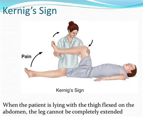 Kernig sign, Brudzinski sign, how to perform Kernig and Brudzinski test