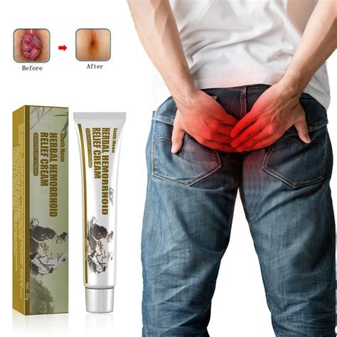 Pomada Anal para hemorroides tratamiento Anal de pilas originales elimina el Spray rápido