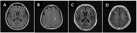 Brain Sciences Free Full Text Heterogeneity Of White Matter