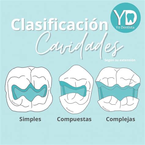 Clasificación cavidades por su extensión