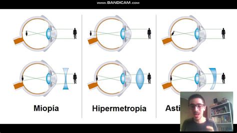 Videoaula Problemas De Visão Youtube