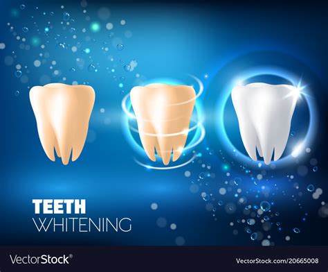 Teeth Whitening Ad Realistic Royalty Free Vector Image