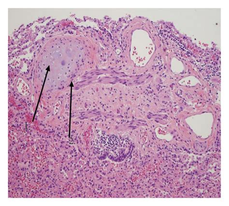 A Haematoxylin And Eosin Staining 10x Original Magnification 1