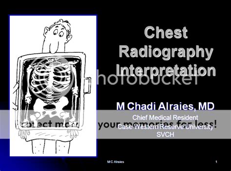 chest radiography interpretation