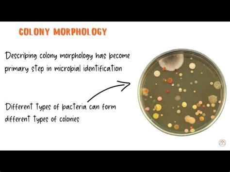 Streptomyces: characteristics, taxonomy, morphology, culture - science ...