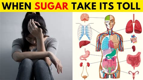 8 Signs Youre Eating Too Much Sugar Youtube