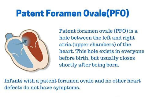 Patent Foramen Ovale PFO Causes Symptoms Diagnosis Treatments