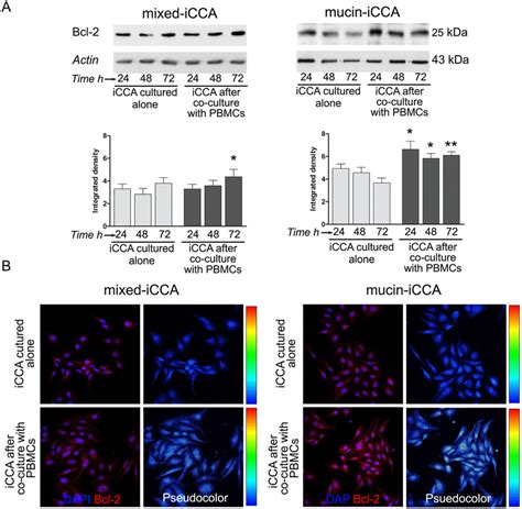 Bcl Expression By Intrahepatic Cholangiocarcinoma Icca Cells A