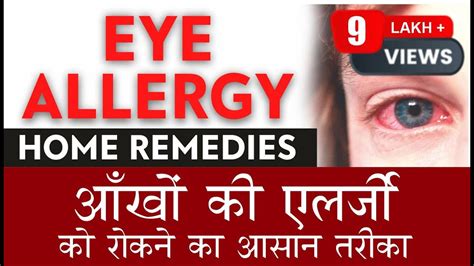 Home Remedies For Eye Allergy Best Treatment For Eye Allergy आँखो की एलर्जी का सही और आसान