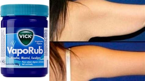 ADIÓS A LOS BRAZOS GORDITOS Y FLACIDOS EN 2 PASOS CON VICK VAPORUB