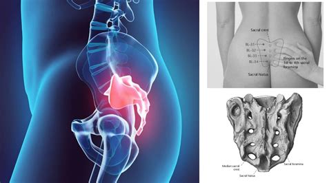 SACRUM LOCATION METHODS AND CUN MEASUREMENTS - YouTube