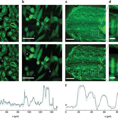 OLEDs With Integrated DBRs For Fluorescence Imaging A Device Stack