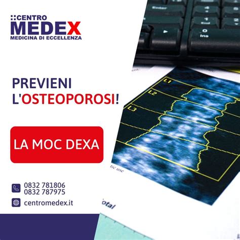 Cos La Moc Dexa Centro Medex