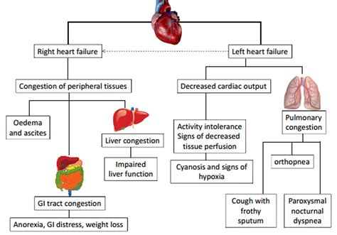 Right And Left Sided Heart Failure | Marilyn Reports