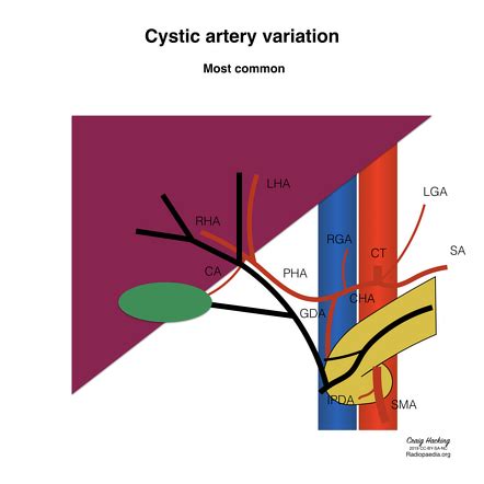 Variant Hepatic Arterial Anatomy Radiology Reference Article