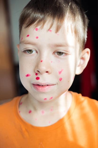 Premium Photo Portrait Of A 10yearold Boy With Chickenpox And A Rash