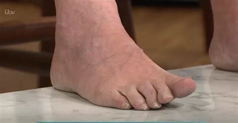 Itv This Morning Flooded With Complaints As Foot Reader Makes Show