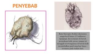 Presentation Scabies Pptx