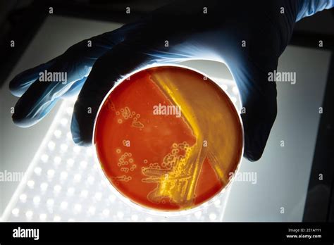 Growing Bacteria In Agar Medium In Microbiology Lab Making Streak In A