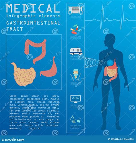 Medical And Healthcare Infographic Gastrointestinal Tract Infographic Stock Vector