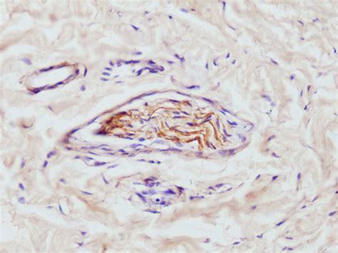 Neurofilament Protein Nfp Positive Slender Axons High Power